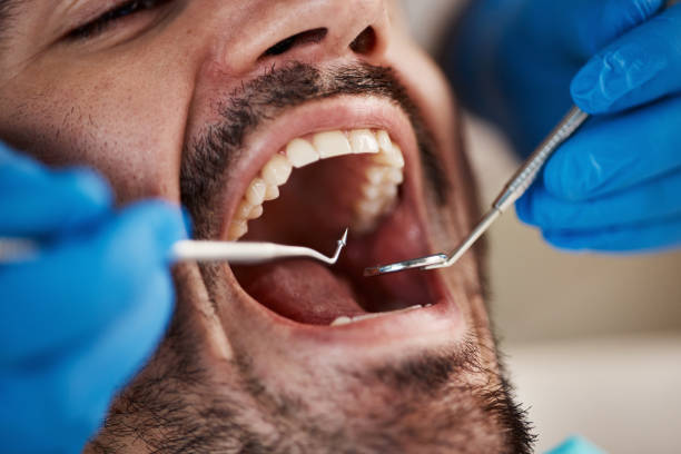 Best Emergency Dental Surgery in Cimarron, KS