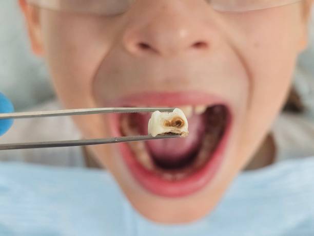 Best Weekend Emergency Dentist in Cimarron, KS