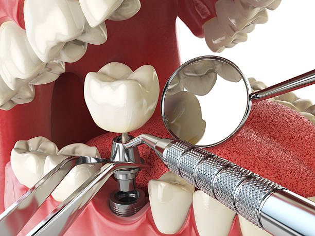 Best Emergency Dental Surgery in Cimarron, KS